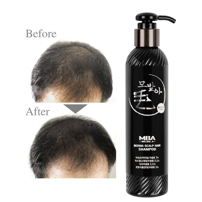 DAYCELL MBA MoBalA Anti Hair Loss Derma Scalp Hair Shampoo 230ml - amazingooh